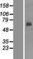 Tyrosinase Protein - Western validation with an anti-DDK antibody * L: Control HEK293 lysate R: Over-expression lysate