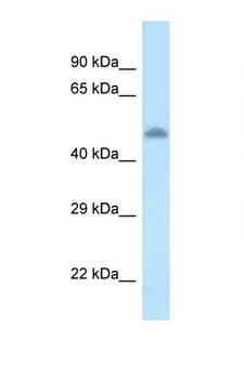Tyrosine Aminotransferase Antibody - TAT / Tyrosine Aminotransferase antibody Western blot of Rat Brain lysate. Antibody concentration 1 ug/ml.  This image was taken for the unconjugated form of this product. Other forms have not been tested.