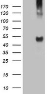 Tyrosine Aminotransferase Antibody - HEK293T cells were transfected with the pCMV6-ENTRY control. (Left lane) or pCMV6-ENTRY TAT. (Right lane) cDNA for 48 hrs and lysed. Equivalent amounts of cell lysates. (5 ug per lane) were separated by SDS-PAGE and immunoblotted with anti-TAT. (1:2000)