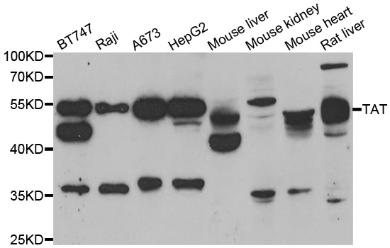 Tyrosine Aminotransferase Antibody - Western blot analysis of extracts of various cell lines.