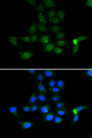Tyrosine Aminotransferase Antibody - Immunofluorescence analysis of MCF7 cells.
