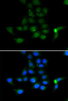 Tyrosine Aminotransferase Antibody - Immunofluorescence analysis of MCF7 cells.
