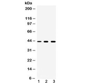 Tyrosine Aminotransferase Antibody - Western blot testing of 1) rat spleen, 2) mouse liver and 3) human A549 cell lysate with TAT antibody at 0.5ug/ml. Expected molecular weight 45-50 kDa.