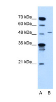 TYRP1 / gp75 Antibody - TYRP1 /gp75 antibody ARP44313_T100-NP_000541-TYRP1(tyrosinase-related protein 1) Antibody Western blot of Jurkat lysate.  This image was taken for the unconjugated form of this product. Other forms have not been tested.