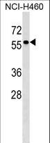TYRP1 / gp75 Antibody - TYRP1 Antibody western blot of NCI-H460 cell line lysates (35 ug/lane). The TYRP1 antibody detected the TYRP1 protein (arrow).