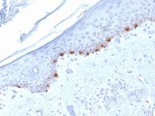 TYRP1 / gp75 Antibody - IHC testing of FFPE human skin with TYRP1 antibody (clone TYRP1/1986). HIER: boil tissue sections in pH6, 10mM citrate buffer, for 10-20 min followed by cooling at RT for 20 min.
