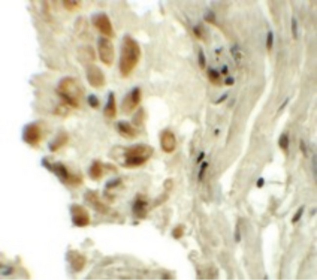 TYW1 Antibody - Immunohistochemistry of TYW1 in human lung tissue with TYW1 antibody at 5 ug/ml.