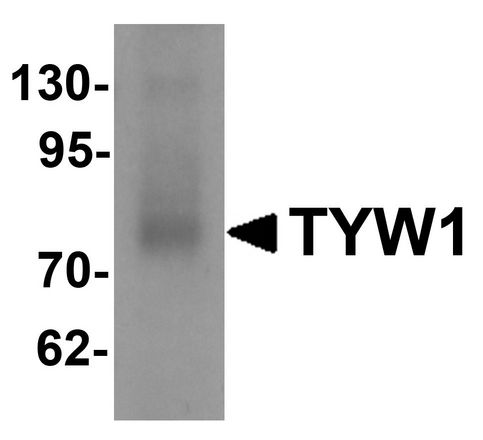 TYW1 Antibody - Western blot analysis of TYW1 in human lung tissue lysate with TYW1 antibody at 1 ug/ml.