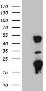 TYW2 / TRMT12 Antibody - HEK293T cells were transfected with the pCMV6-ENTRY control. (Left lane) or pCMV6-ENTRY TRMT12. (Right lane) cDNA for 48 hrs and lysed