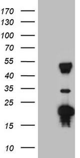 TYW2 / TRMT12 Antibody - HEK293T cells were transfected with the pCMV6-ENTRY control. (Left lane) or pCMV6-ENTRY TRMT12. (Right lane) cDNA for 48 hrs and lysed. Equivalent amounts of cell lysates. (5 ug per lane) were separated by SDS-PAGE and immunoblotted with anti-TRMT12. (1:2000)