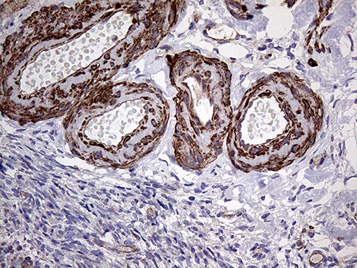 TYW2 / TRMT12 Antibody - Immunohistochemical staining of paraffin-embedded Human Ovary tissue within the normal limits using anti-TRMT12 mouse monoclonal antibody. (Heat-induced epitope retrieval by 1mM EDTA in 10mM Tris buffer. (pH8.5) at 120°C for 3 min. (1:500)