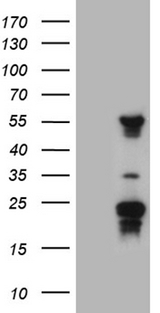 TYW2 / TRMT12 Antibody - HEK293T cells were transfected with the pCMV6-ENTRY control. (Left lane) or pCMV6-ENTRY TRMT12. (Right lane) cDNA for 48 hrs and lysed. Equivalent amounts of cell lysates. (5 ug per lane) were separated by SDS-PAGE and immunoblotted with anti-TRMT12. (1:2000)