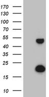TYW2 / TRMT12 Antibody - HEK293T cells were transfected with the pCMV6-ENTRY control. (Left lane) or pCMV6-ENTRY TRMT12. (Right lane) cDNA for 48 hrs and lysed