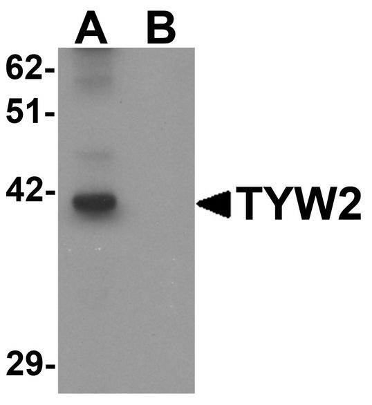 TYW2 / TRMT12 Antibody - Western blot analysis of TYW2 in K562 cell lysate with TYW2 antibody at 0.5 ug/ml in (A) the absence and (B) the presence of blocking peptide.