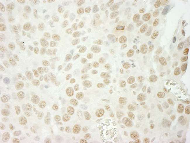 U2AF1 Antibody - Detection of Mouse U2AF35 by Immunohistochemistry. Sample: FFPE section of mouse colon carcinoma. Antibody: Affinity purified rabbit anti-U2AF35 used at a dilution of 1:250.