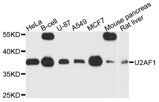 U2AF1 Antibody - Western blot analysis of extracts of various cells.