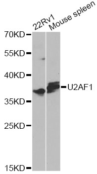 U2AF1 Antibody - Western blot analysis of extracts of various cell lines, using U2AF1 antibody at 1:1000 dilution. The secondary antibody used was an HRP Goat Anti-Rabbit IgG (H+L) at 1:10000 dilution. Lysates were loaded 25ug per lane and 3% nonfat dry milk in TBST was used for blocking. An ECL Kit was used for detection and the exposure time was 90s.