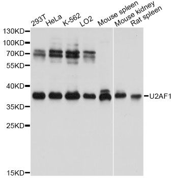 U2AF1 Antibody - Western blot analysis of extracts of various cell lines, using U2AF1 antibody at 1:3000 dilution. The secondary antibody used was an HRP Goat Anti-Rabbit IgG (H+L) at 1:10000 dilution. Lysates were loaded 25ug per lane and 3% nonfat dry milk in TBST was used for blocking. An ECL Kit was used for detection and the exposure time was 3s.
