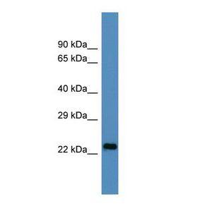 U2AF1L4 Antibody - Western blot of Human HepG2. U2AF1L4 antibody dilution 1.0 ug/ml.  This image was taken for the unconjugated form of this product. Other forms have not been tested.