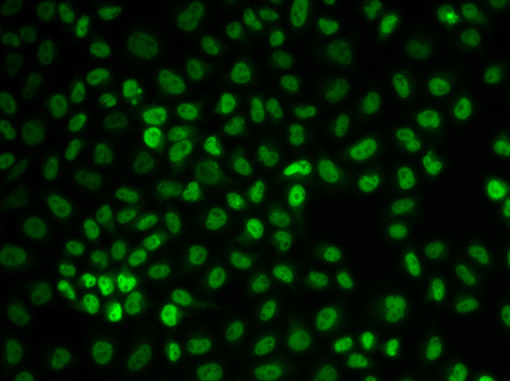 U2AF2 / U2AF65 Antibody - Immunofluorescence analysis of U2OS cells.