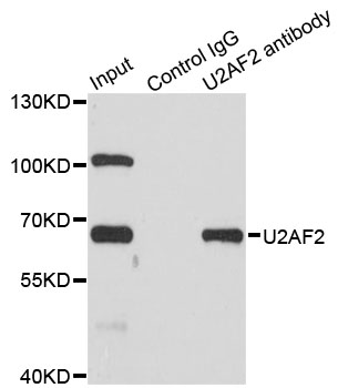 U2AF2 / U2AF65 Antibody - Immunoprecipitation analysis of 200ug extracts of SW620 cells.