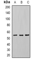U2AF2 / U2AF65 Antibody - Western blot analysis of U2AF65 expression in Jurkat (A); SW620 (B); mouse spleen (C) whole cell lysates.
