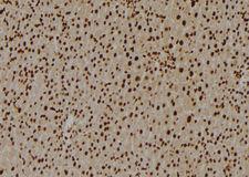 U2AF2 / U2AF65 Antibody - 1:100 staining rat liver tissue by IHC-P. The sample was formaldehyde fixed and a heat mediated antigen retrieval step in citrate buffer was performed. The sample was then blocked and incubated with the antibody for 1.5 hours at 22°C. An HRP conjugated goat anti-rabbit antibody was used as the secondary.