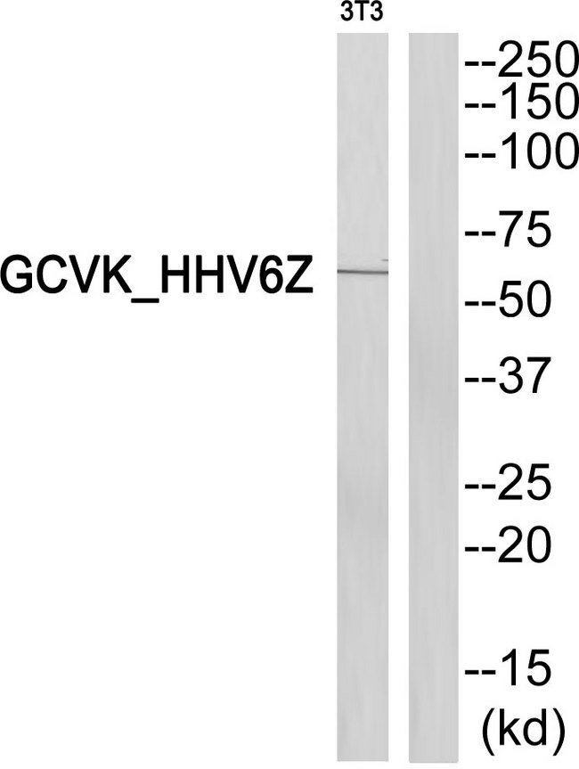 U69 Antibody - Western blot of extracts from 3T3cells, using GCVK_HHV6Z antibody.