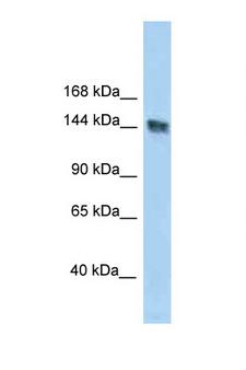UACA Antibody - UACA antibody Western blot of Fetal Lung lysate. Antibody concentration 1 ug/ml.  This image was taken for the unconjugated form of this product. Other forms have not been tested.