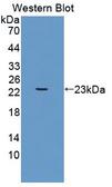 UACA Antibody - Western blot of UACA antibody.