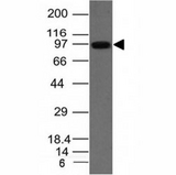 UACA Antibody - Western blot of A549 cell lysate using UACA antibody (UACA/1222).  This image was taken for the unmodified form of this product. Other forms have not been tested.