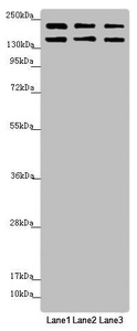 UACA Antibody - Western blot All Lanes: UACA antibody at 5.51ug/ml Lane 1: Hela whole cell lysate Lane 2: A549 whole cell lysate Lane 3: Jurkat whole cell lysate Secondary Goat polyclonal to rabbit IgG at 1/10000 dilution Predicted band size: 163,162 kDa Observed band size: 163,190 kDa