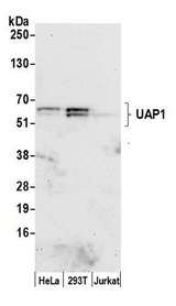 UAP1 Antibody - Detection of human UAP1 by western blot. Samples: Whole cell lysate (50 µg) from HeLa, HEK293T, and Jurkat cells prepared using NETN lysis buffer. Antibody: Affinity purified rabbit anti-UAP1 antibody used for WB at 1:1000. Detection: Chemiluminescence with an exposure time of 30 seconds.