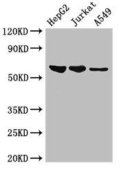 UAP1 Antibody - Positive WB detected in:HepG2 whole cell lysate,Jurkat whole cell lysate,A549 whole cell lysate;All lanes:UAP1 antibody at 2.5?g/ml;Secondary;Goat polyclonal to rabbit IgG at 1/50000 dilution;Predicted band size: 59,58 KDa;Observed band size: 59 KDa;