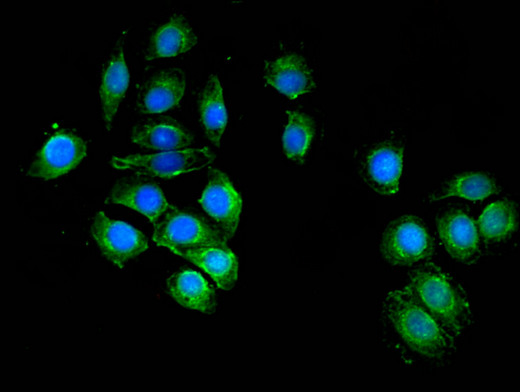 UAP1 Antibody - Immunofluorescent analysis of A549 cells using UAP1 Antibody at a dilution of 1:100 and Alexa Fluor 488-congugated AffiniPure Goat Anti-Rabbit IgG(H+L)