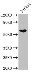 UAP1 Antibody - Western Blot Positive WB detected in: Jurkat whole cell lysate All lanes: UAP1 antibody at 2.5µg/ml Secondary Goat polyclonal to rabbit IgG at 1/50000 dilution Predicted band size: 59, 58 kDa Observed band size: 59 kDa