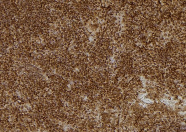 UAP1 Antibody - 1:100 staining mouse spleen tissue by IHC-P. The sample was formaldehyde fixed and a heat mediated antigen retrieval step in citrate buffer was performed. The sample was then blocked and incubated with the antibody for 1.5 hours at 22°C. An HRP conjugated goat anti-rabbit antibody was used as the secondary.