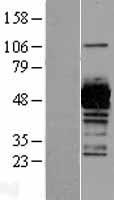 UAP1 Protein - Western validation with an anti-DDK antibody * L: Control HEK293 lysate R: Over-expression lysate