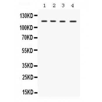 UBA1 / UBE1 Antibody - Western blot analysis of UBA1 expression in rat liver extract (lane 1), mouse liver extract (lane 2), mouse testis extract (lane 3) and HELA whole cell lysates (lane 4). UBA1 at 117 kD was detected using rabbit anti- UBA1 Antigen Affinity purified polyclonal antibody at 0.5 ug/mL. The blot was developed using chemiluminescence (ECL) method.