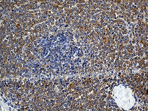 UBA3 / UBE1C Antibody - Immunohistochemical staining of paraffin-embedded Human spleen tissue within the normal limits using anti-UBA3 mouse monoclonal antibody. (Heat-induced epitope retrieval by 1mM EDTA in 10mM Tris buffer. (pH8.5) at 120°C for 3 min. (1:500)