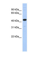 UBA3 / UBE1C Antibody - UBA3 / UBE1C antibody Western blot of Fetal Pancreas lysate. This image was taken for the unconjugated form of this product. Other forms have not been tested.