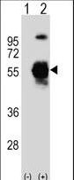 UBA3 / UBE1C Antibody - Western blot of UBE1C (arrow) using rabbit polyclonal UBE1C Antibody (S430). 293 cell lysates (2 ug/lane) either nontransfected (Lane 1) or transiently transfected (Lane 2) with the UBE1C gene.