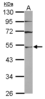 UBA3 / UBE1C Antibody - Sample (30 ug of whole cell lysate) A: A431 10% SDS PAGE UBA3 / UBE1C antibody diluted at 1:3000