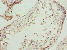 UBA3 / UBE1C Antibody - Immunohistochemistry of paraffin-embedded human testis tissue at dilution 1:100