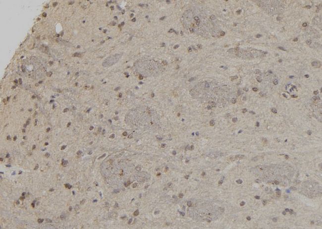 UBA3 / UBE1C Antibody - 1:100 staining rat brain tissue by IHC-P. The sample was formaldehyde fixed and a heat mediated antigen retrieval step in citrate buffer was performed. The sample was then blocked and incubated with the antibody for 1.5 hours at 22°C. An HRP conjugated goat anti-rabbit antibody was used as the secondary.
