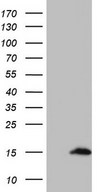 UBA52 Antibody - HEK293T cells were transfected with the pCMV6-ENTRY control (Left lane) or pCMV6-ENTRY UBA52 (Right lane) cDNA for 48 hrs and lysed. Equivalent amounts of cell lysates (5 ug per lane) were separated by SDS-PAGE and immunoblotted with anti-UBA52.