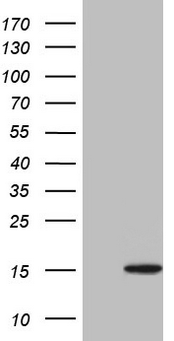 UBA52 Antibody - HEK293T cells were transfected with the pCMV6-ENTRY control. (Left lane) or pCMV6-ENTRY UBA52. (Right lane) cDNA for 48 hrs and lysed. Equivalent amounts of cell lysates. (5 ug per lane) were separated by SDS-PAGE and immunoblotted with anti-UBA52.