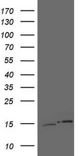 UBA52 Antibody - HEK293T cells were transfected with the pCMV6-ENTRY control. (Left lane) or pCMV6-ENTRY UBA52. (Right lane) cDNA for 48 hrs and lysed. Equivalent amounts of cell lysates. (5 ug per lane) were separated by SDS-PAGE and immunoblotted with anti-UBA52.