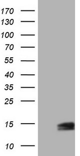 UBA52 Antibody - HEK293T cells were transfected with the pCMV6-ENTRY control. (Left lane) or pCMV6-ENTRY UBA52. (Right lane) cDNA for 48 hrs and lysed. Equivalent amounts of cell lysates. (5 ug per lane) were separated by SDS-PAGE and immunoblotted with anti-UBA52.