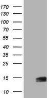 UBA52 Antibody - HEK293T cells were transfected with the pCMV6-ENTRY control (Left lane) or pCMV6-ENTRY UBA52 (Right lane) cDNA for 48 hrs and lysed. Equivalent amounts of cell lysates (5 ug per lane) were separated by SDS-PAGE and immunoblotted with anti-UBA52.